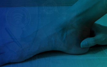 Blog Thumbnail Image